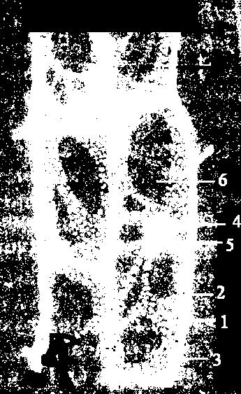 Citologija Slika 3. Ćelije epidermisa sočnih listova lukovice crnog luka (Allium cepa) Rotaciono kretanje citoplazme Deo lista valisnerije (Vallisneria spiralis L.