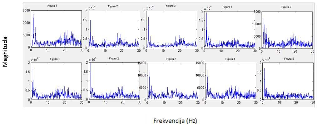 Spektri EEG signala snimljeni za vreme crtanja jednog objekta, snimljenih elektrodom na poziciji T3 prikazani su na slici 6.