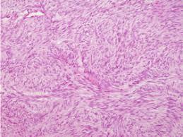 Sljedeće metode koje su bitne kod dijagnosticiranja tumora, odnosno mioma maternice: mikroskopiranje (patohistologija) - promjene na razini stanice, odnosno strukture tkiva histokemija promjene na