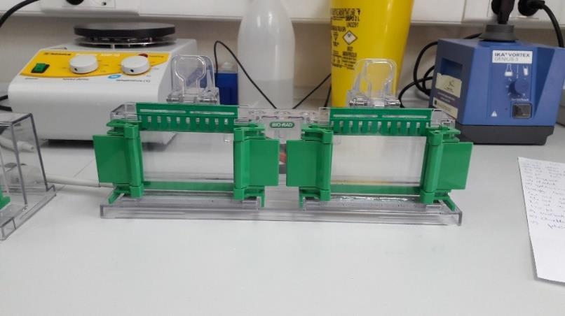 4. Materijali i metode 4.3. Western blot Za sve mjerne parametre koristit će se Western Blot metoda.