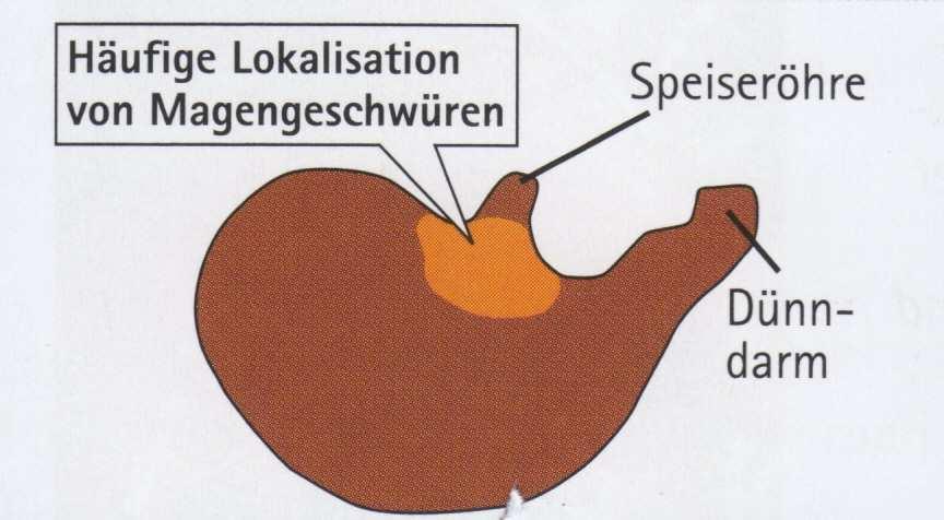 Arbocel kod tovljenika Kanibalizam Prevencija želudačnog čira Fino mlevena hrana sa niskim sadržajem vlakana pogoduje pojavi čira Prevalent localisation of gastric ulcers