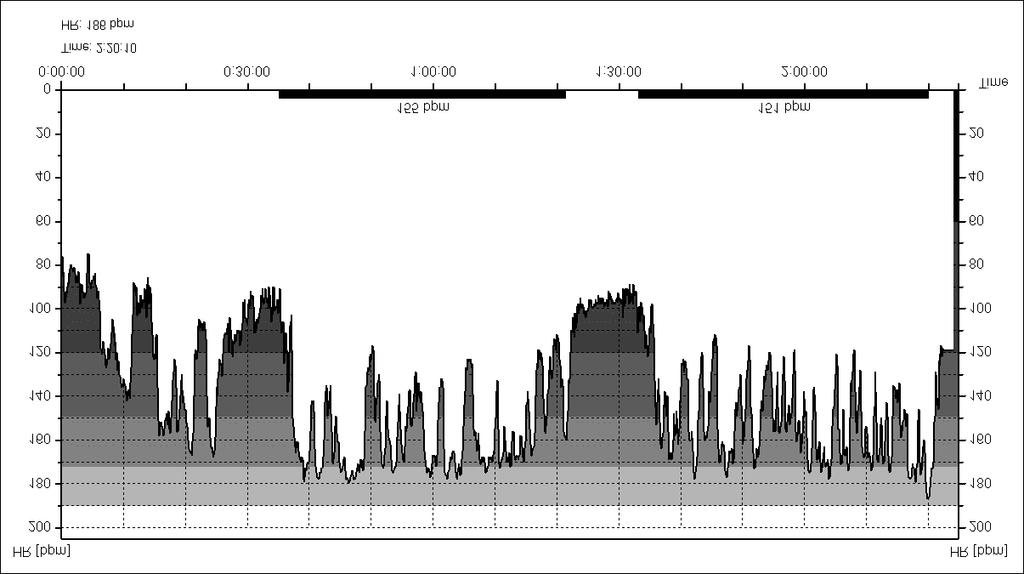 STRUČNI RADOVI IZVAN TEME Grafički prikaz 1. Primjer kretanja frekvencije srca tijekom nogometne utakmice jednog ispitanika 2.3.
