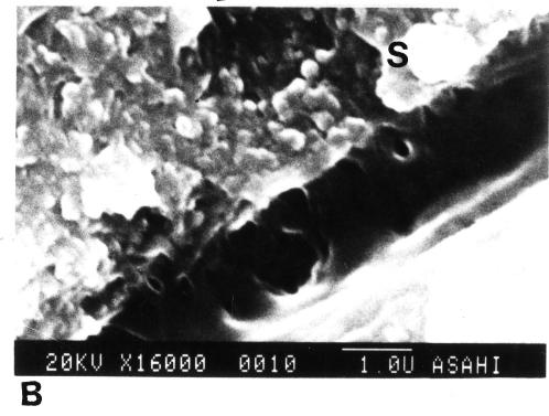 Afterwards, they were put in vacuum chamber and covered with gold in 30Å depth. Slika 2 SEM fotografija mle nog o njaka sa nele enim karijesom: A.