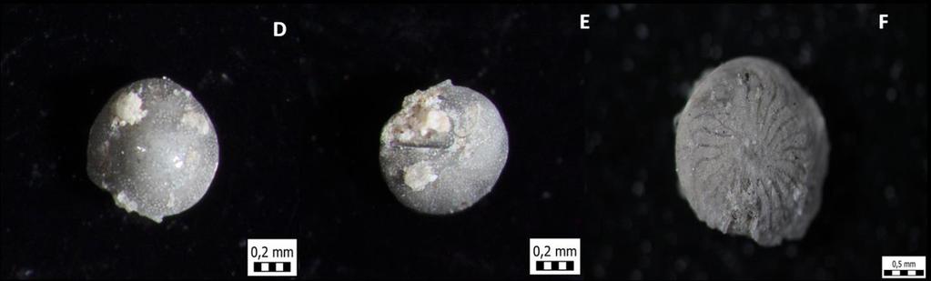 Slika 26. a), b) Biasterigerina planorbis (uzorak 6); c) Amphistegina sp. (uzorak 1) Ostrakodi Podrazred ostrakoda pripada podkoljenu Crustacea (raci) te koljenu Arthropoda (člankonošci).