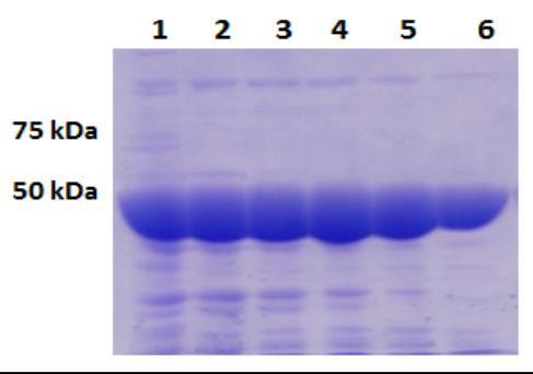 A) kromatogram dobiven nakon pročišćavanja SerRS ionsko-izmjenjivačkom kromatografijom na anionsko-izmjenjivačkoj koloni MonoQ (GE Healthcare), B) analiza odabranih frakcija na 9 %-tnom SDS gelu