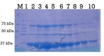 1.4. Rezultati 37 ogranaka proteina.