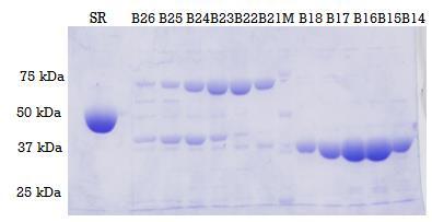 1.4. Rezultati 43 razrijeđenja SerRS-a (prvi uzorak najveće koncentracije 37,5 μmol dm 3 ). U svaki od uzoraka dodana je ista količina fluorescentno obilježenog BEN1 (slika 24, str. 43).