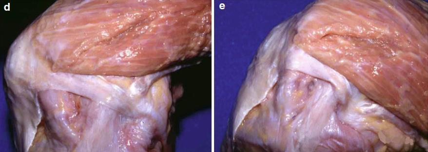 ( Preuzeto iz Anterior Knee Pain and Patellar Instability, Sanchis- Alfonso et al.