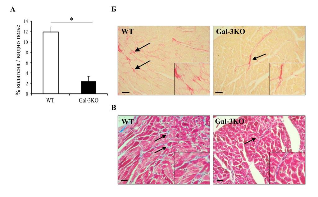 Слика 5. Одсуство експресије гена за Gal-3 значајно смањује депоновање колагена у срцу. А.
