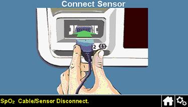 Ako se senzor odvoji od sistema za monitoring Ako se senzor odvoji od sistema za monitoring, pojavljuje se ekran prikazan desno.