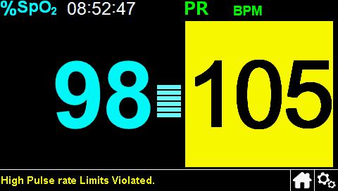 Ako se oglasi alarm za brzinu pulsa Ako se pojavi velika ili mala brzina pulsa, videćete žutu pozadinu na očitanoj vrednosti brzine pulsa, kao i poruku u dnu ekrana.