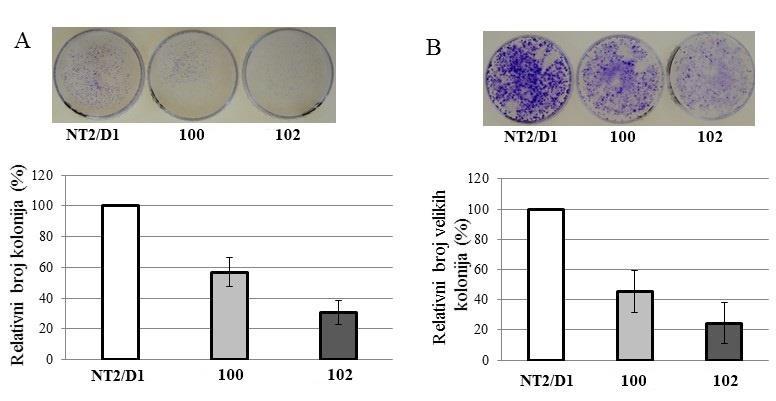 102 pokazuje veću sposobnost inhibicije formiranja kolonija ćelija T2/D1, čak 70%, u poređenju sa 40% ostvarene inhibicije jedinjenja 100. lika 39.