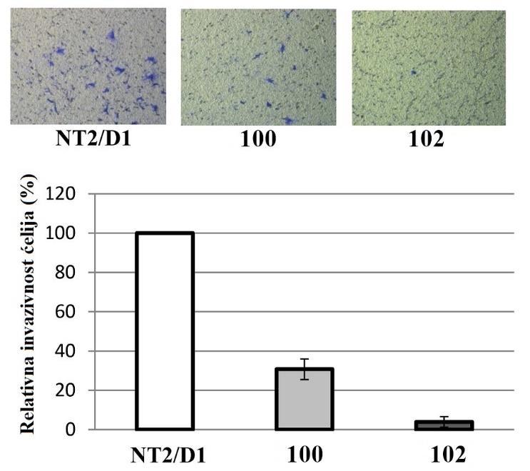 lika 41. Inhibicija invazivnosti ćelija T2/D1 jedinjenjima 100 (c = 0,2 µm) i 102 (c = 0,1 µm) 3.5.