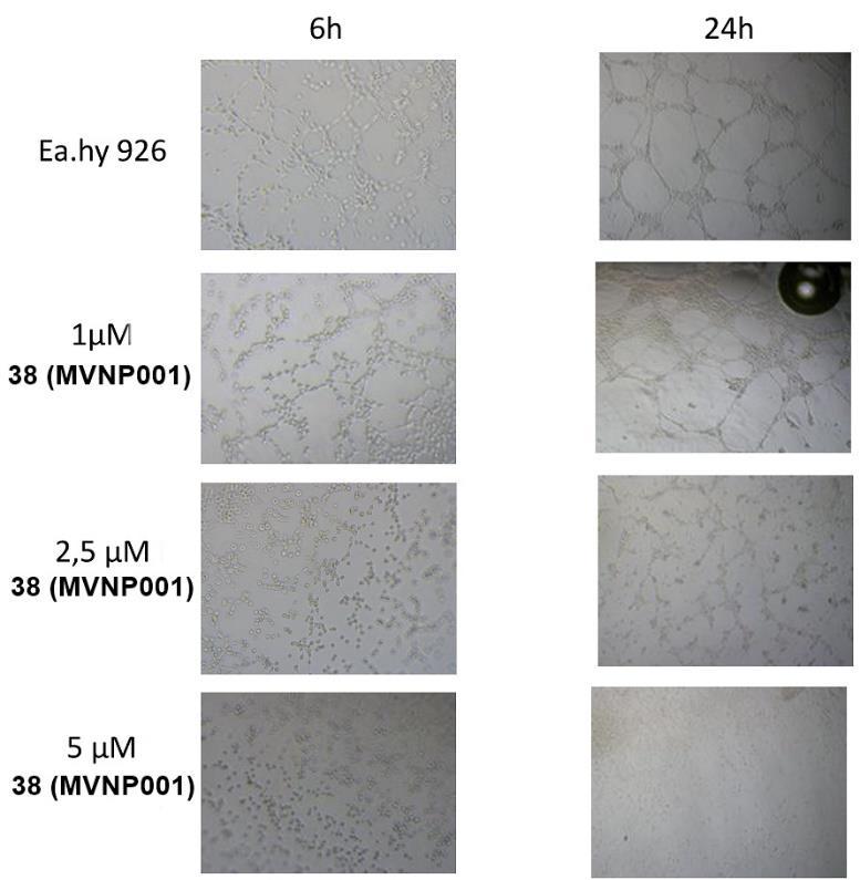 lika 42. Inhibicija formiranja mreže endotelnih ćelija Ea.hy926 u Matrigelu nakon 6 sati i 24 sata tretmana jedinjenjem 38 (MVP001) (1, 2,5 i 5 µm) Fotografije tretiraniih ćelija Ea.
