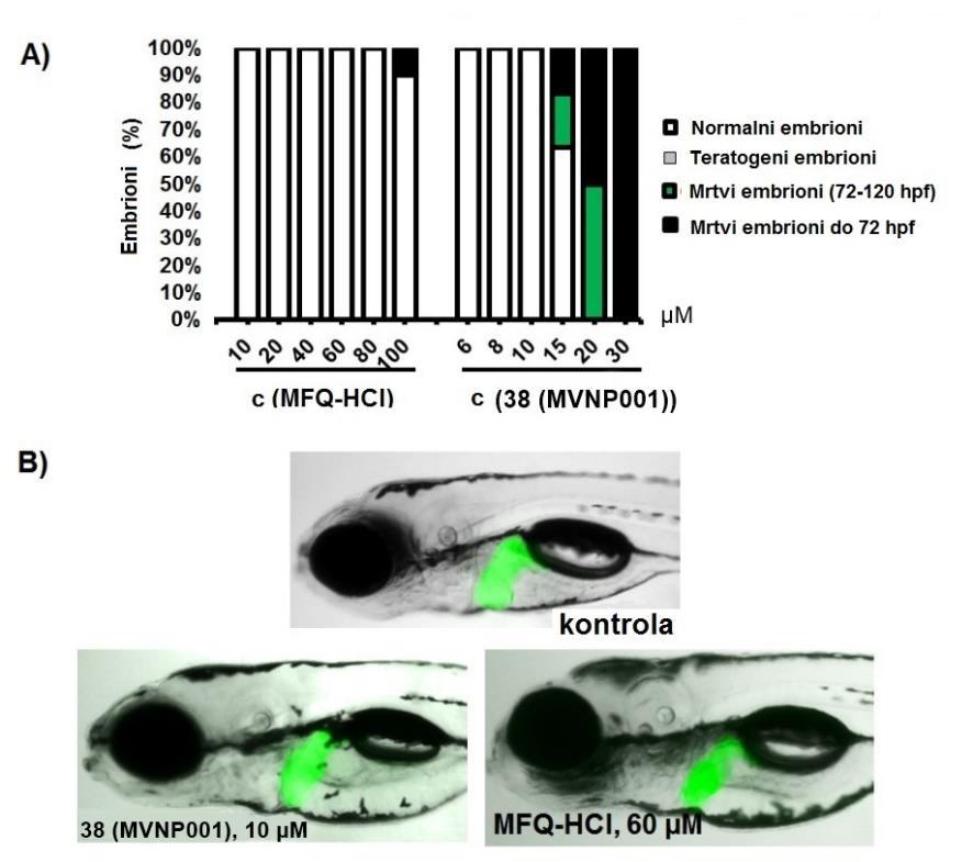 Rezultati ispitivanja teratogenosti i hepatotoksičnosti jedinjenja 38 (MVP001) prema embrionima zebra-ribica prikazani su na slici 43.