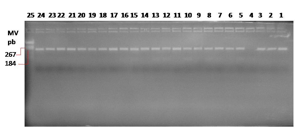 Slika 9. prikazuje provjeru uspješnosti umnažanja PCR produkta koji obuhvaća COMT Val158Met polimorfizam. Veličina PCR produkta iznosi 184 pb.