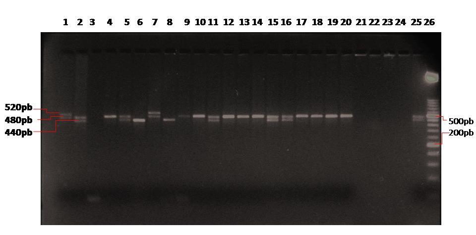 4.2.2 Polimorfizam DAT-VNTR Dobiveni PCR fragmenti razlikuju se po veličini te se njihovim razdvajanjem na gelu može odrediti genotip.