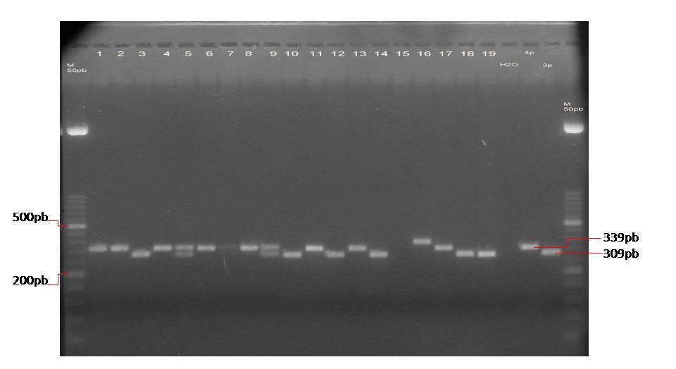 4.2.3 Polimorfizam MAOA-uVNTR Kao i u slučaju dopaminskog transportera, umnoženi PCR fragmenti razlikuju se prema veličini.