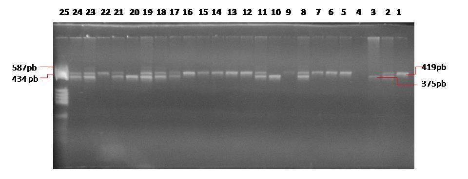 4.2.4 5-HTTLPR polimorfizam PCR-om umnoženi fragmenti 5-HTTLPR polimorfizma razlikuju se po veličini te su razdvojeni elektroforezom. Genotip je očitan prema unaprijed definiranoj shemi.