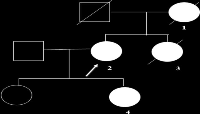 Shema 11. Porodično stablo nosioca tačkaste mutacije Arg418X u egzonu 10 GRN gena U jednog bolesnika pokazana je tačkasta mutacija (g.