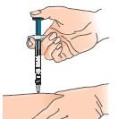 E) Priprema injekcije 1 Odaberite područje injiciranja (pogledajte savjet na početku dijagrama na kraju ovog Dodatka) te zabilježite mjesto u svojim bilješkama o primjeni injekcije.