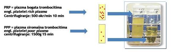 Slika 10. Priprema uzoraka PRP-a i PPP-a centrifugiranjem venske krvi 3.3.1.2.