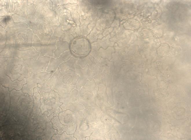 Slika 9. Žlezdana dlaka na licu lista S. officinalis, Sićevačka klisura (x 40) Slika 10. Žlezdana dlaka na naličju lista S.
