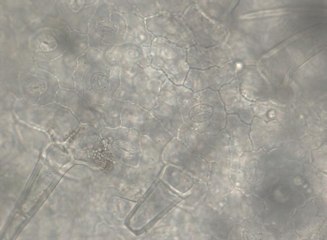 Najveći broj stoma je okružen sa 2 ćelije (Slika 13. i 14.).