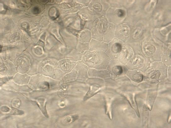 Antiklinalni zidovi ćelija epidermisa naličja lista su ravni do blago izuvijani (Slika 18. i 20.).