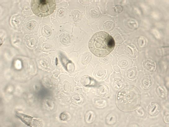austriaca, Vidlič Vazganica (x 40) Slika 36. Indumentum naličja lista S. austriaca, Vidlič Vazganica (x 40) Dlake su gušće raspoređene oko glavnog nerva, pri osnovi su šire a sužavaju se ka vrhu.