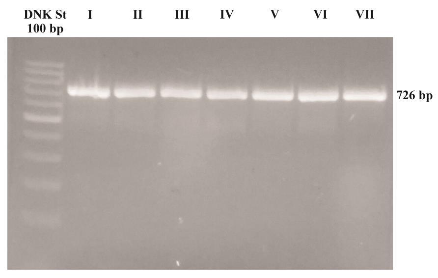 Rezultati istraživanja Slika 21. Agarozna elektroforeza za proveru PCR reakcije za MYD88 L265P Tadić Lj.