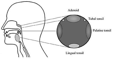 (tonzila) i to ždrijelne tonzile, dvije tubarne tonzile, dvije nepčane tonzile, i jezične tonzile, te malih nakupina limfatičnog tkiva u mukozi ždrijela (Slika 1) (13). Slika 1.