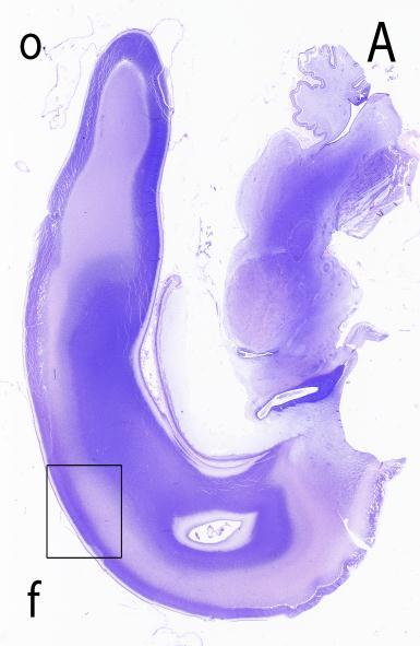 Slika 4. Sagitanli presjek kroz fetalni telencefalon u dobi 18 TG, bojeno metodom po Nisslu (A, B) i prikaz imunoreaktivnosti tenascina C (C) u subplate zoni (SP).