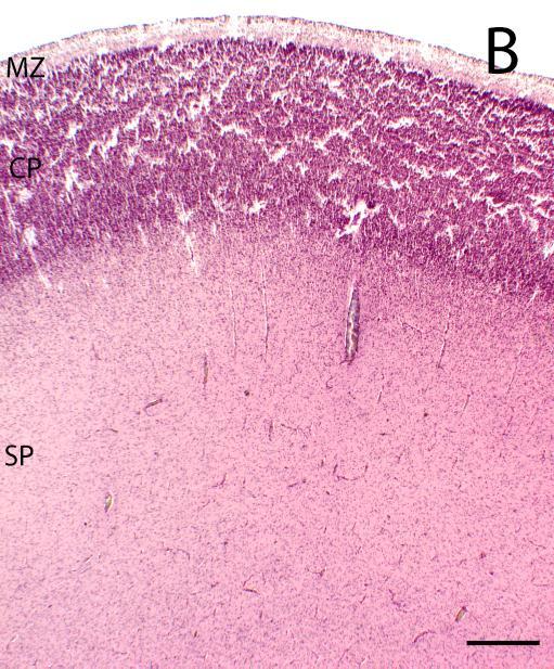 TG je pozitivna u površnom uskom sloju subplate zone, što predstavlja zadnju imunohistokemijsku reaktivnost na tenascin C u ovom prikazu izraţaja tenascina C u fetalnom razvoju humanog telencefalona.