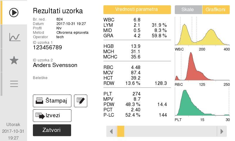 3. Rad (analiza uzorka) Rezultati Metoda 2: Kada se završi analiza hitnog uzorka, izaberite dugme Aparat za autom.