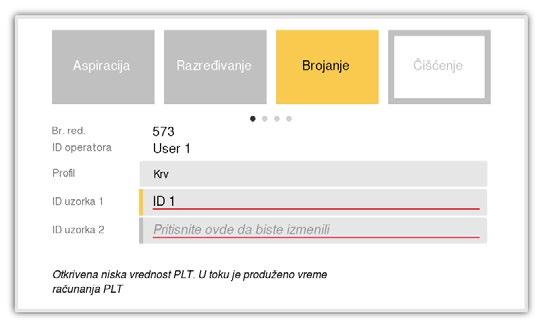 3. Rad (analiza uzorka) Rezultati Produženo vreme računanja PLT-a Slika 55: Faze računanja za produženo vreme računanja PLT-a Ako je produženo vreme računanja PLT-a uključeno (pogledati odeljak 7) i