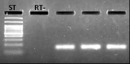 Slika 8. Elektroforeza reprezentativnih produkata umnožavanja cdna za serotoninski receptor 2C metodom lančane reakcije polimerazom u stvarnom vremenu.