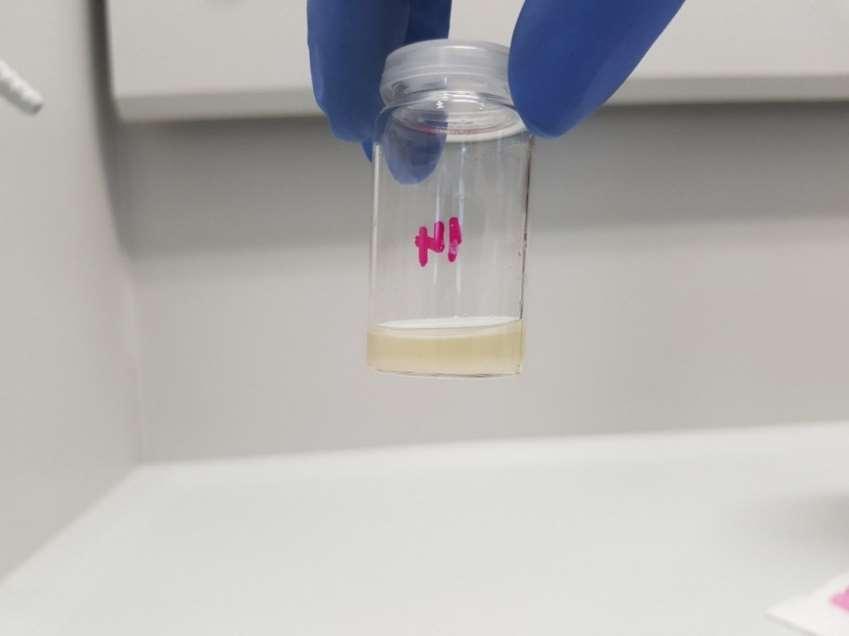 Kada je Na2SO4 postao sipak, pažljivo, pomoću mikropipete, uzimamo organski sloj (gornji) i prenosimo ga u vialicu koju začepimo