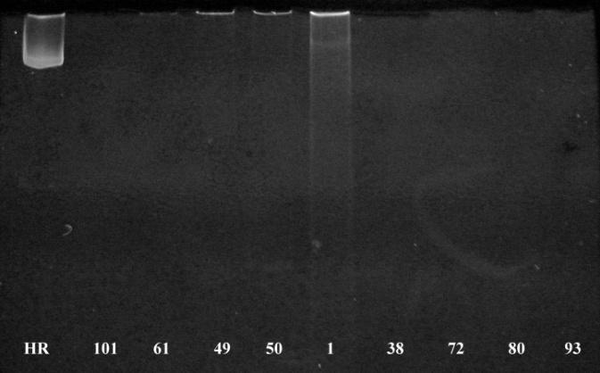 Slika 6. Rezultat elektroforetske analize uzoraka dsrna tretiranih DNAzom (brojevi predstavljaju laboratorijske oznake uzoraka opisanih u Tablici 16., str.