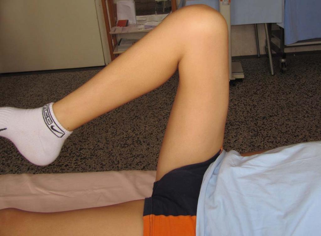 p GALS o Aktivni pokret fleksije i ekstenzije kolena