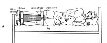 Postupci nege Faza imobilizacije pozicioniranje u postelji; statičke i dinamičke kontrakcije prevencija sekundarnih komplikacija pluća-stazna