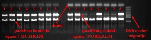 Umnožene produkte PCR smo prije provjere na gelu pomiješali s 3µl boje.