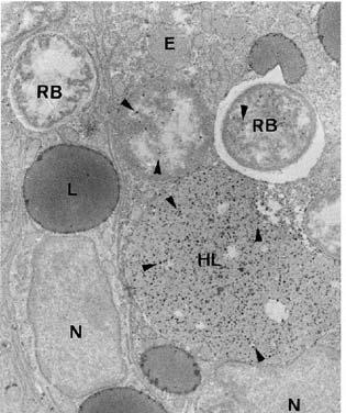 UVOD Slika 4. Elektronsko-mikroskopska slika endosoma (E), heterolizosoma (HL) i rezidualnih tjelešaca (RB) u stanicama probavne žlijezde mediteranske dagnje M. galloprovincialis (Robledo i sur.