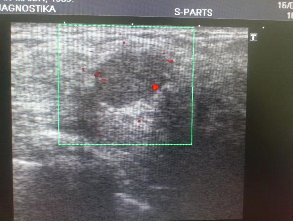 oblasti ultrazvučne terapije /uz talasi u fizikalnoj medicini/ koriste ultrazvučni talasi frekvencije od 20 40 MHz.