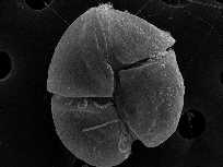 Neke od takvih vrsta, kao dinoflagelati, Karenia mikimoto (slika 1. i 2.), koja tvori algalne cvatove visoke gustoće s više od milijun stanica po litri te stvara velike probleme. Slika 1.