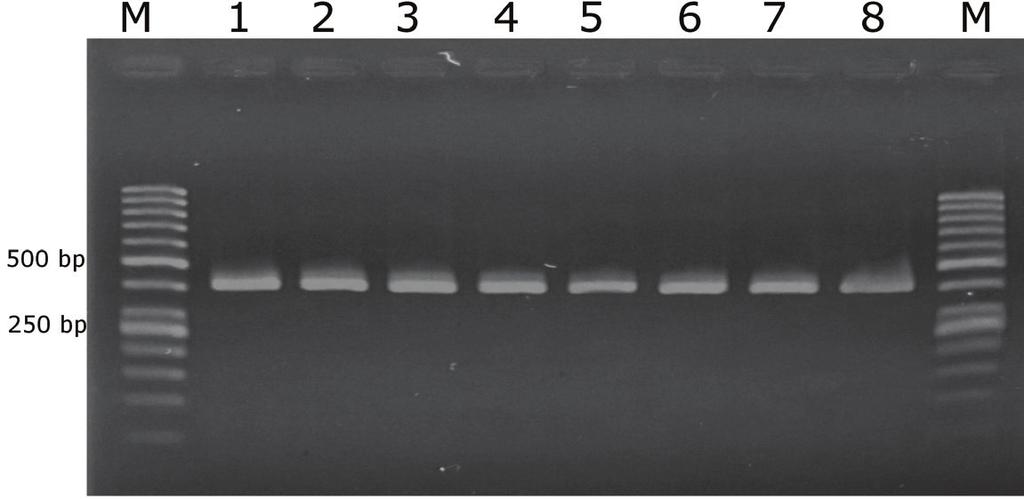 Slika 1. Prikaz rezultata dobijenih na agaroznom gelu obojenom u etidijum bromidu. Babesia spp. daje trake veličine 410bp.