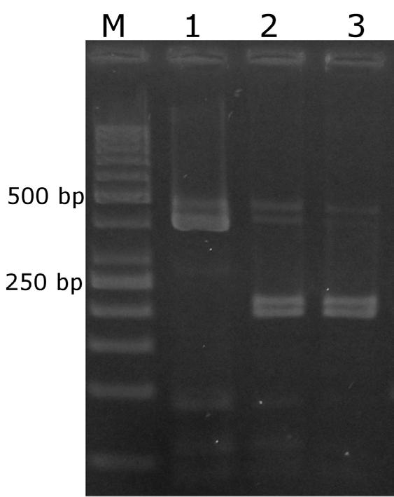 M-Marker (50bp DNA ladder Nippon Genetics, Germany); 1-8 positive samples for Babesia spp. analize su prikazani na slici 2. Nije bilo ni jednog slučaja B. vogeli, B. microti-like i B. rossi.
