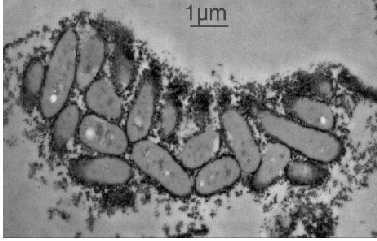 slučajevima, minerali željeznog sulfida koji su proizvedeni od strane sulfat reducirajućih bakterija još nisu bili sistematski ispitani elektronskom mikroskopijom visoke rezolucije.