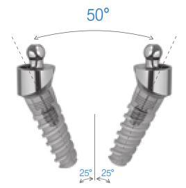 Ove pod kutovima ispravljaju meďusobnu nagnutost implantata od 30 i 50 (Slika 36).