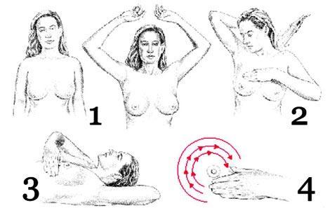 Slika 4. Samopregled dojke (sjedeći i ležeći položaj) (24) 1.5.3. Ultrazvuk dojki Ultrazvuk je dijagnostička metoda izbora za žene mlađe životne dobi i komplementarna metoda mamografiji.